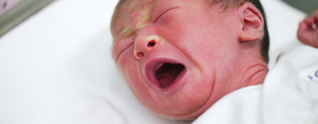 Infeksi Gonore Bisa Menyerang Mata Bayi, Apa Penyebabnya?