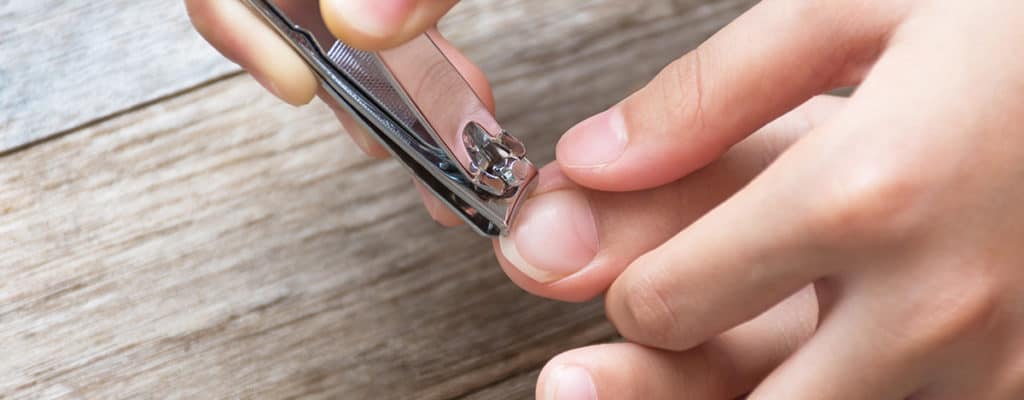 Nyut-Nyutan Terus Akibat Cantengan? Lakukan 4 Cara Sederhana Ini untuk Mengatasinya