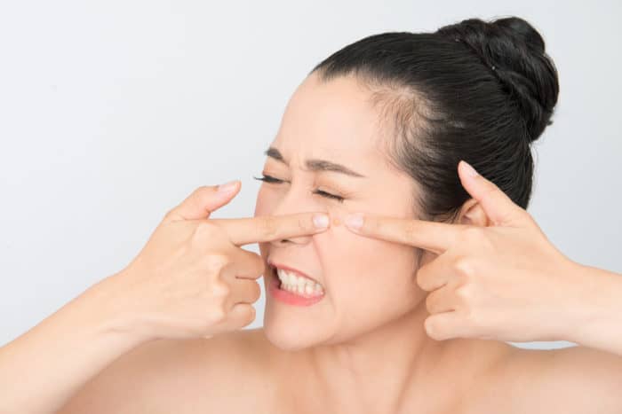 ipl treatment cara menghilangkan jerawat