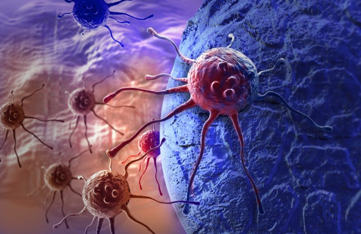 kanker dan tumor