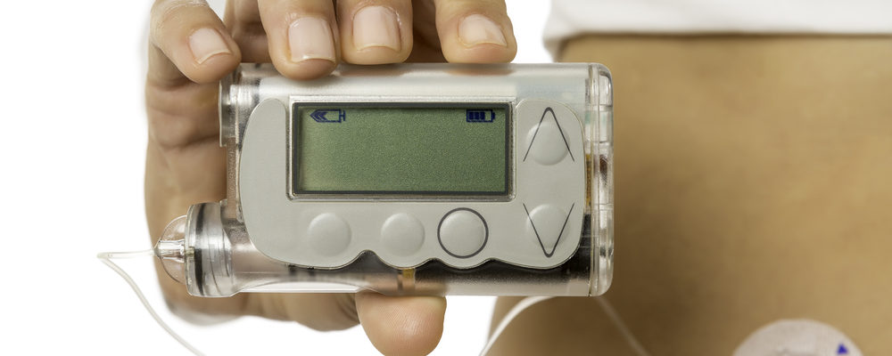 Takut Suntik? Pompa Insulin Jadi Solusi untuk Diabetesi