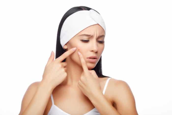 obat jerawat perih