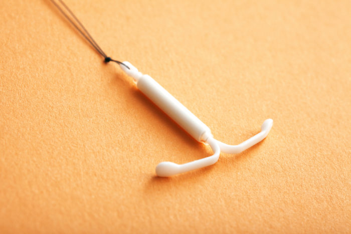 melepas IUD lepas KB spiral