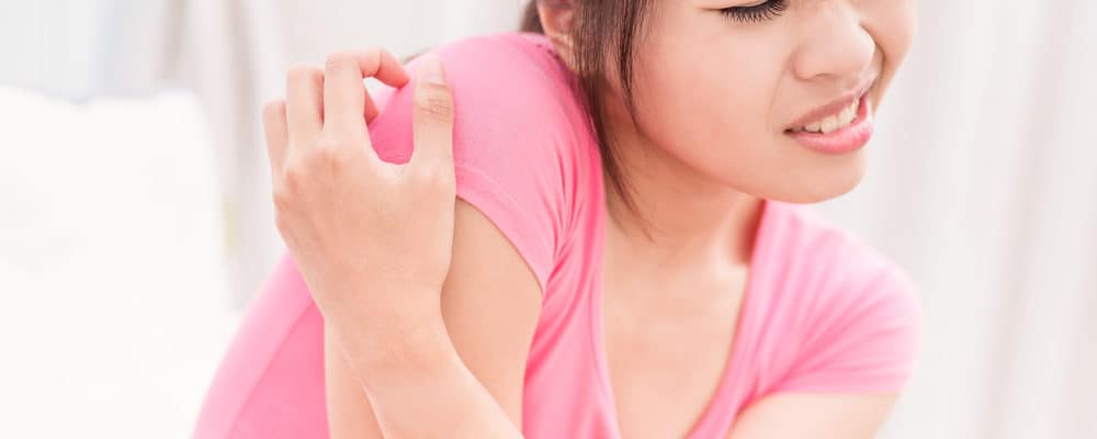 5 Cara Alami Merawat Kulit yang Berpanu Supaya Cepat Sembuh