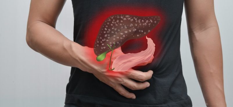 penyakit hepatitis adalah