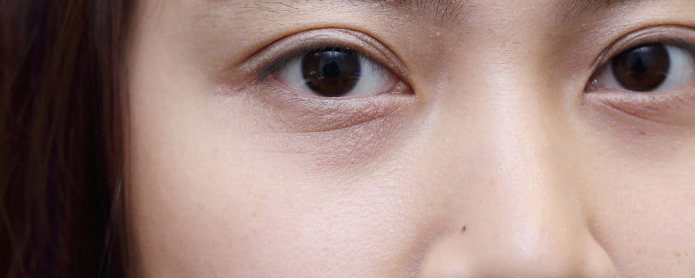 4 Jenis Komplikasi Diabetes yang Menyerang Mata