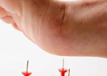 5 Hal yang Sering Jadi Penyebab Mati Rasa pada Kaki dan Tangan