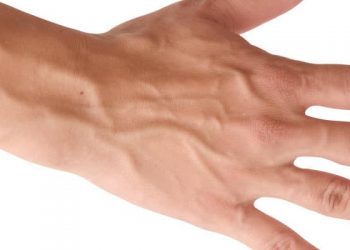 6 Penyebab Urat Anda Menonjol dan Terlihat Jelas di Kulit