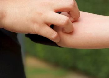 5 Langkah Mudah Mengatasi Kulit Gatal Karena Diabetes