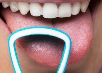 Mengatasi Gangguan pada Lidah Dimulai dengan Menjaga Kebersihannya