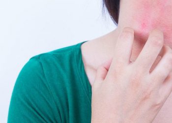 Kenapa Rasa Gatal Malah Semakin Parah Jika Digaruk?