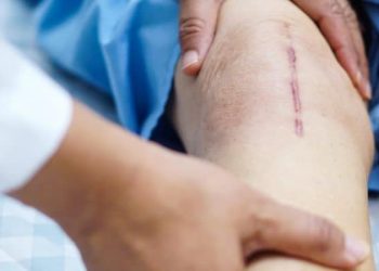 Pertolongan Pertama dan Penanganan untuk Luka Gores