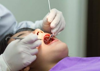 4 Persiapan Sebelum Perawatan Saluran Akar Gigi (Root Canal Treatment)