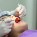 4 Persiapan Sebelum Perawatan Saluran Akar Gigi (Root Canal Treatment)
