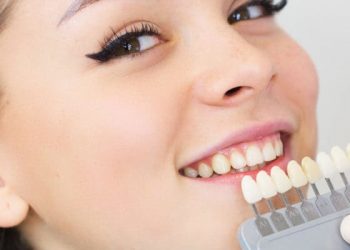 Semua yang Perlu Anda Ketahui tentang Veneer Gigi