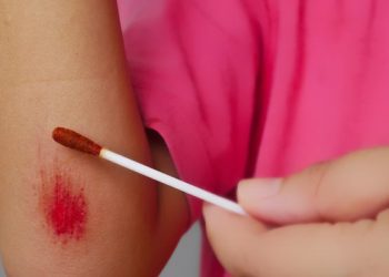 Perawatan Luka dan Proses Penyembuhan Luka, Begini Penjelasannya