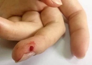 Luka Tusuk: Pertolongan Pertama dan Perawatannya