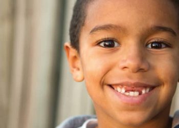 Mulai Kapan Gigi Susu Anak Copot? Apakah Pasti Akan Copot Semua?