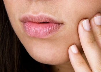 Penyebab dan Cara Ampuh Mengatasi Sariawan di Lidah