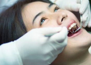 Mengenal Berbagai Jenis Tambalan Gigi dan Cara Merawatnya