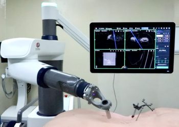 Satu-satunya di Indonesia, Eka Hospital Dilengkapi Robot Navigasi untuk Operasi Skoliosis