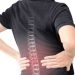 Jangan Sepelekan Nyeri Punggung! Bisa Jadi Pertanda Saraf Kejepit