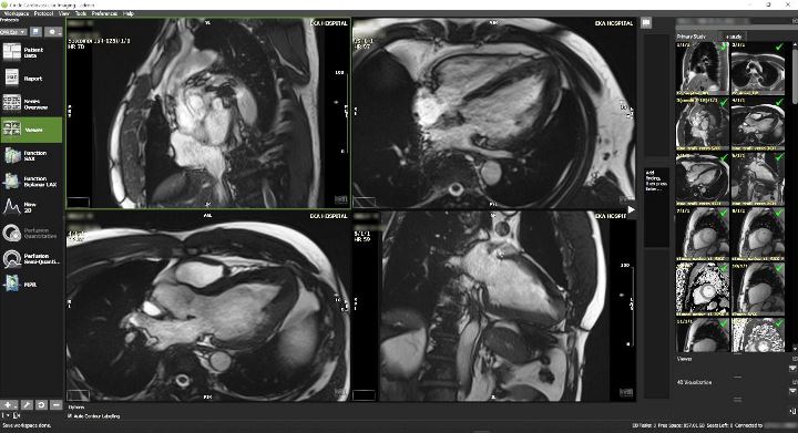 Ilustrasi cardiac imaging. (IST)