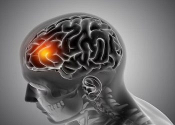 Dokter Spesialis Eka Hospital BSD Beri Penjelasan Soal Diffuse Axonal Injury