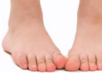 Benarkah Kelainan Tulang Kaki X dan O pada Anak Karena Kebiasaan Membedong?