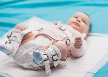 Kenali Gangguan Hip Dysplasia pada Bayi