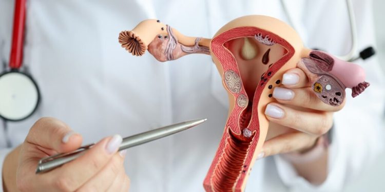 Ilustrasi pap smear. (yooha.id)