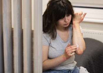 Psoriasis: Penyakit Autoimun Kronis yang Bisa Dikendalikan dengan Perawatan Tepat