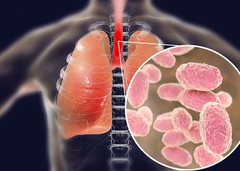 Waspadai Penyakit Batuk Rejan pada Anak, Tidak Ditangani dengan Tepat Bisa Fatal Akibatnya 