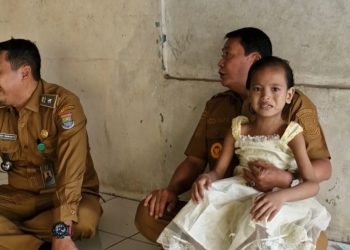 Bupati Tangerang Klarifikasi Kabar Pemasungan Anak di Legok