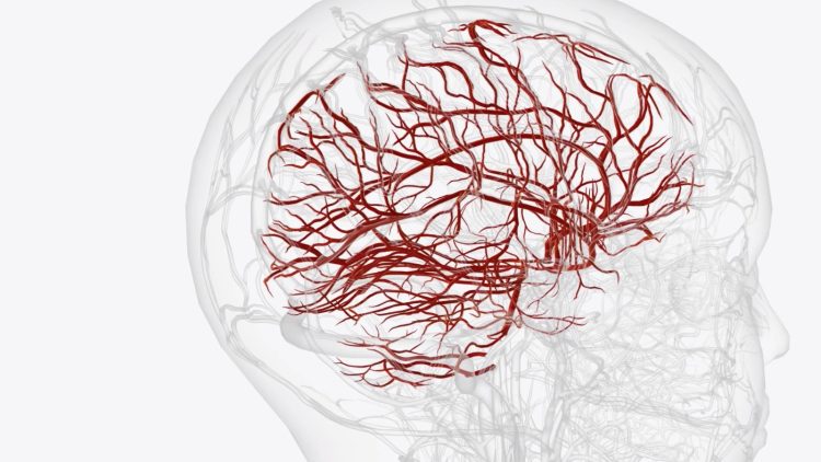 Ilustrasi Gangguan Pembuluh Darah Otak. (sumber foto: Freepik).