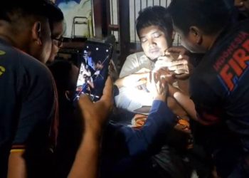 Bukan Cuma Padamkan Api, Damkar Kota Tangerang Keluarkan Benda Asing di Hidung Anak